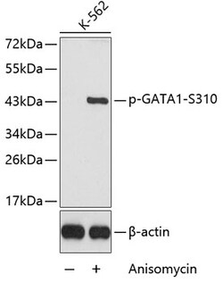 ABclonal Technology&nbsp;Phospho-GATA1-S310 Rabbit pAb
