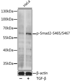 ABclonal Technology&nbsp;Phospho-Smad2-S465/S467 Rabbit pAb