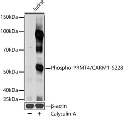 ABclonal Technology&nbsp;Phospho-PRMT4/CARM1-S228 Rabbit pAb