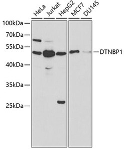 ABclonal Technology&nbsp;DTNBP1 Rabbit pAb