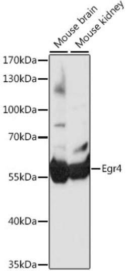 ABclonal Technology&nbsp;Egr4 Rabbit pAb