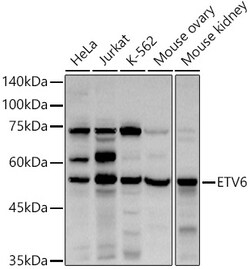 ABclonal Technology&nbsp;ETV6 Rabbit pAb