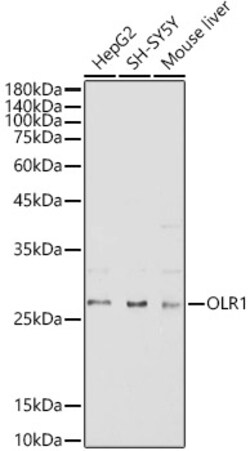 ABclonal Technology&nbsp;OLR1 Rabbit pAb