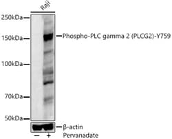 ABclonal Technology Phospho-PLC gamma 2 (PLCG2)-Y759 Rabbit pAb