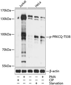 ABclonal Technology&nbsp;Phospho-PRKCQ-T538 Rabbit pAb