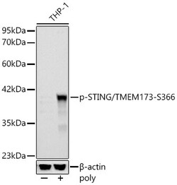 ABclonal Technology&nbsp;Phospho-STING/TMEM173-S366 Rabbit pAb