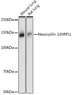 ABclonal Technology&nbsp;Neuropilin-1 (NRP1) Rabbit pAb