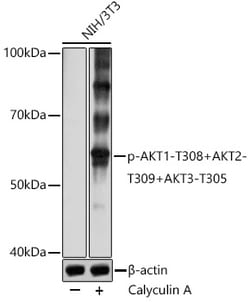 ABclonal Technology&nbsp;Phospho-AKT1-T308+AKT2-T309+AKT3-T305 Rabbit pAb