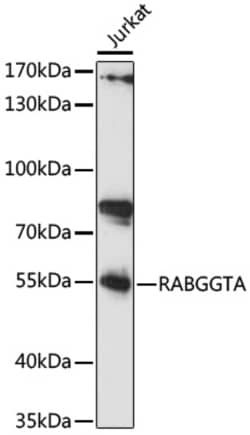 ABclonal Technology&nbsp;RABGGTA Rabbit pAb