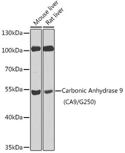 ABclonal Technology&nbsp;Carbonic Anhydrase 9 (CA9/G250) Rabbit pAb