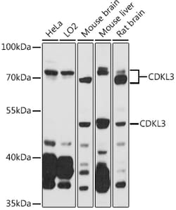 ABclonal Technology&nbsp;CDKL3 Rabbit pAb
