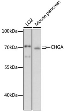 ABclonal Technology&nbsp;CHGA Rabbit pAb