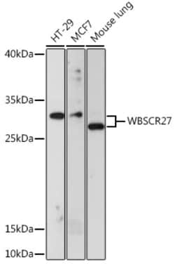 ABclonal Technology&nbsp;WBSCR27 Rabbit pAb