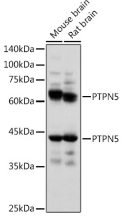 ABclonal Technology&nbsp;PTPN5 Rabbit pAb