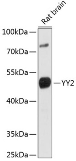 ABclonal Technology&nbsp;YY2 Rabbit pAb