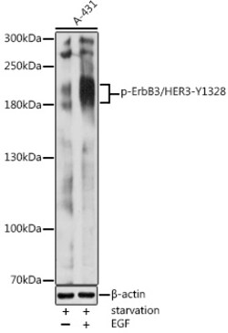 ABclonal Technology&nbsp;Phospho-ErbB3/HER3-Y1328 Rabbit pAb