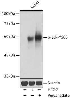 ABclonal Technology&nbsp;Phospho-Lck-Y505 Rabbit pAb