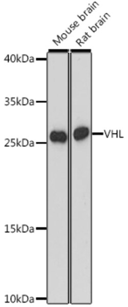 ABclonal Technology&nbsp;VHL Rabbit pAb