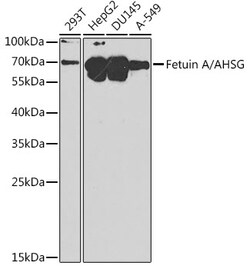 ABclonal Technology&nbsp;Fetuin A/AHSG Rabbit pAb