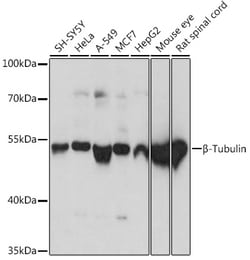 ABclonal Technology&nbsp;β-Tubulin Rabbit pAb