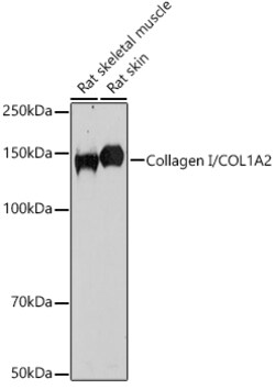 ABclonal Technology&nbsp;Collagen I/COL1A2 Rabbit pAb
