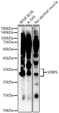 ABclonal Technology&nbsp;SFRP5 Rabbit pAb