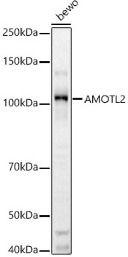 ABclonal Technology&nbsp;AMOTL2 Rabbit pAb