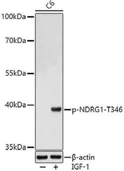 ABclonal Technology&nbsp;Phospho-NDRG1-T346 Rabbit pAb