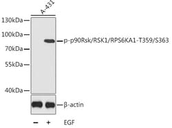 ABclonal Technology&nbsp;Phospho-p90Rsk/RSK1/RPS6KA1-T359/S363 Rabbit pAb