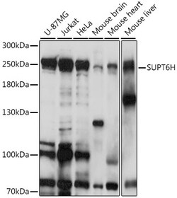 ABclonal Technology&nbsp;SUPT6H Rabbit pAb