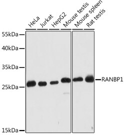 ABclonal Technology&nbsp;RANBP1 Rabbit pAb