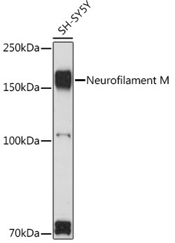 ABclonal Technology&nbsp;Neurofilament M Rabbit pAb