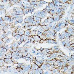 ABclonal Technology&nbsp;δ-Catenin/p120 Catenin Rabbit pAb
