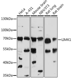 ABclonal Technology&nbsp;LIMK1 Rabbit pAb