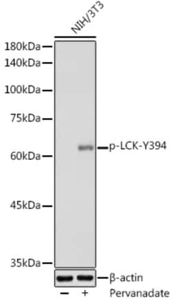 ABclonal Technology&nbsp;Phospho-LCK-Y394 Rabbit pAb