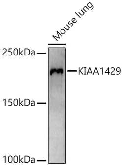 ABclonal Technology&nbsp;KIAA1429 Rabbit pAb