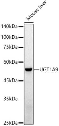 ABclonal Technology&nbsp;UGT1A9 Rabbit pAb