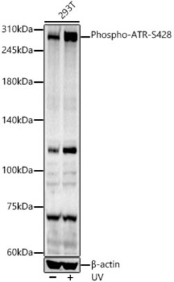 ABclonal Technology&nbsp;Phospho-ATR-S428 Rabbit pAb