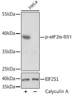 ABclonal Technology&nbsp;Phospho-eIF2α-S51 Rabbit pAb