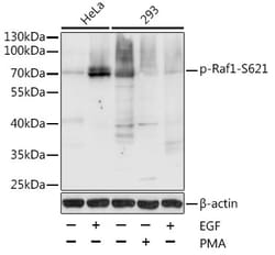 ABclonal Technology Phospho-Raf1-S621 Rabbit pAb