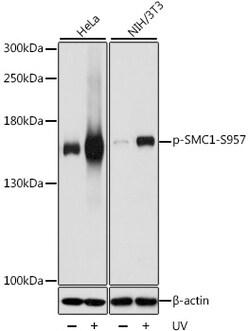 ABclonal Technology&nbsp;Phospho-SMC1-S957 Rabbit pAb