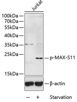 ABclonal Technology&nbsp;Phospho-MAX-S11 Rabbit pAb
