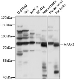 ABclonal Technology&nbsp;MARK2 Rabbit pAb