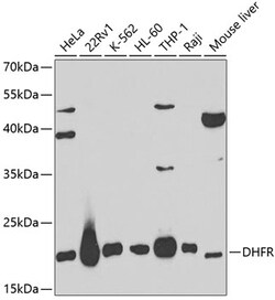 ABclonal Technology&nbsp;DHFR Rabbit pAb