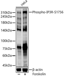 ABclonal Technology&nbsp;Phospho-IP3R-S1756 Rabbit pAb