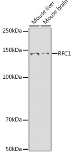 ABclonal Technology&nbsp;RFC1 Rabbit pAb