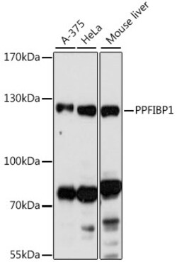 ABclonal Technology&nbsp;PPFIBP1 Rabbit pAb
