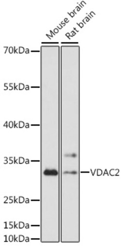 ABclonal Technology&nbsp;VDAC2 Rabbit pAb