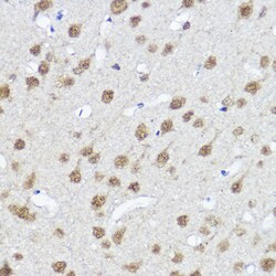 ABclonal Technology&nbsp;MYOCD Rabbit pAb
