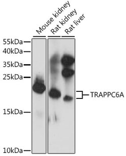 ABclonal Technology&nbsp;TRAPPC6A Rabbit pAb